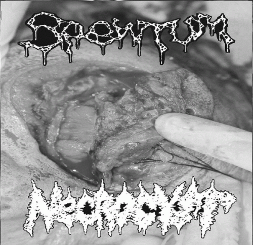 Spewtum : Spewtum - Necrocyst